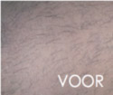 vol ontharen voor